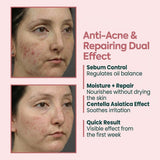 Acne & Pimple Cream with Zinc PCA, Centella, Niacinamide - 40ml - TryAladdin