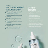 Anti - Blackhead & Acne Serum with Niacinamide & Zinc PCA - 50ml - TryAladdin