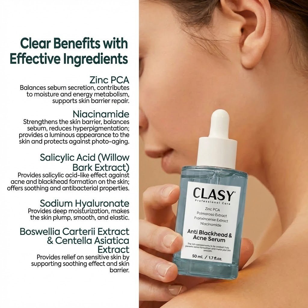 Anti - Blackhead & Acne Serum with Niacinamide & Zinc PCA - 50ml - TryAladdin
