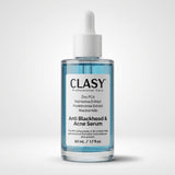 Anti - Blackhead & Acne Serum with Niacinamide & Zinc PCA - 50ml - TryAladdin