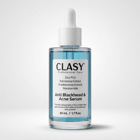 Anti - Blackhead & Acne Serum with Niacinamide & Zinc PCA - 50ml - TryAladdin