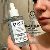 Anti - Blackhead & Acne Serum with Niacinamide & Zinc PCA - 50ml - TryAladdin