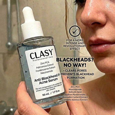 Anti - Blackhead & Acne Serum with Niacinamide & Zinc PCA - 50ml - TryAladdin