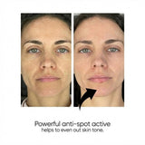 Brightening Anti - Spot & Pore Tightening Toner Set - 2x200ml - TryAladdin