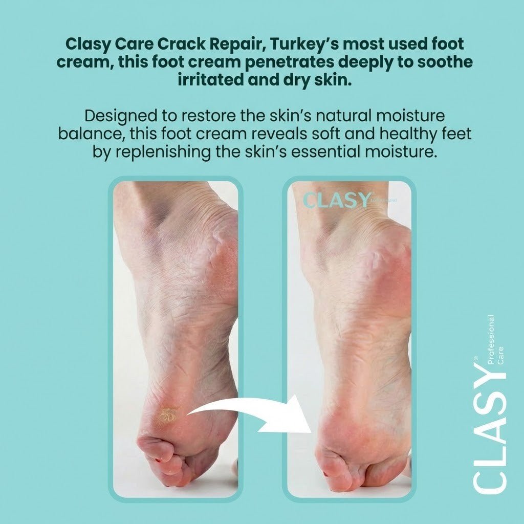 Crack Repair Foot & Heel Cream for Dry, Cracked Skin - 100ml - TryAladdin