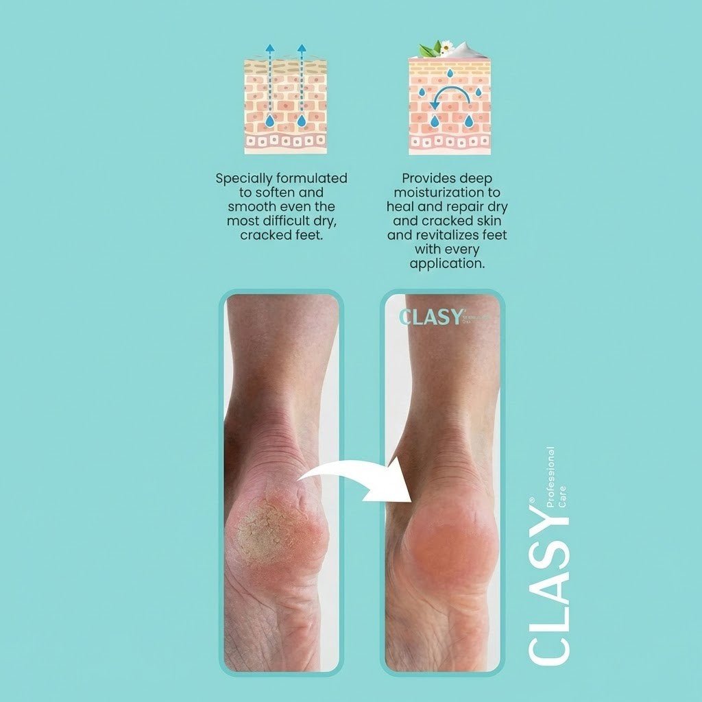 Crack Repair Foot & Heel Cream for Dry, Cracked Skin - 100ml - TryAladdin