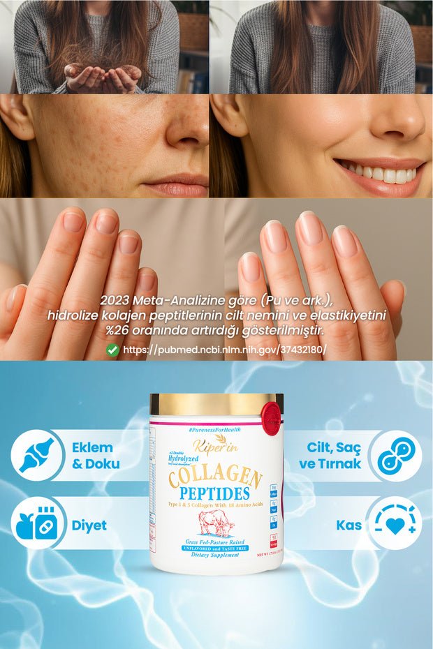 Double Hydrolyzed Collagen Peptides - 500g Unflavored Powder - TryAladdin