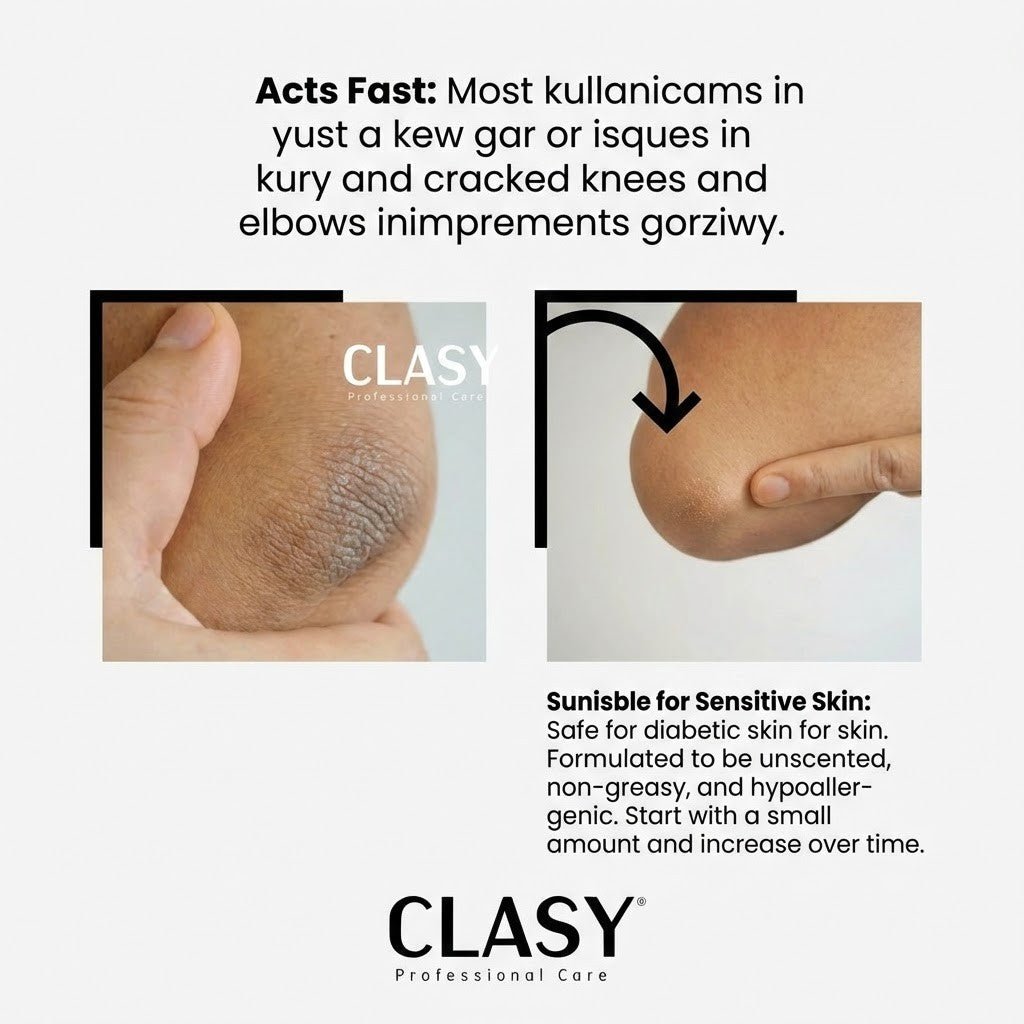 Elbow & Knee Crack Repair Cream - Deeply Hydrates & Softens Rough Skin - TryAladdin