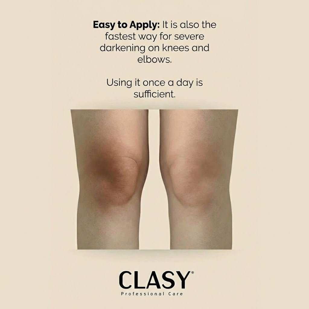 Elbow & Knee Crack Repair Cream - Deeply Hydrates & Softens Rough Skin - TryAladdin