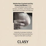 Elbow & Knee Crack Repair Cream - Deeply Hydrates & Softens Rough Skin - TryAladdin