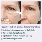 Face Up Skin Under Eye Cream - Caffeine 5%, Hyaluronic Acid 2% - 40ml - TryAladdin