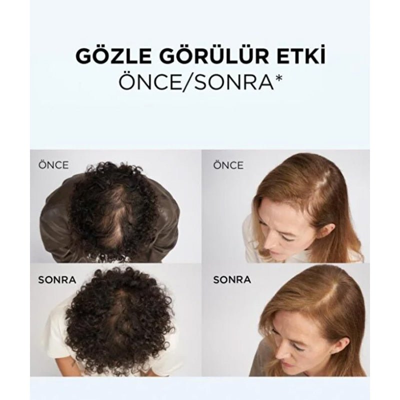 Hair Conditioner - Anti - Hair Loss & Thickening with Niacinamide & Ginger - TryAladdin