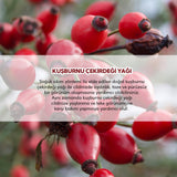 Pure Rosehip Seed Oil - Brightening, Hydrating & Anti - Aging Elixir - TryAladdin